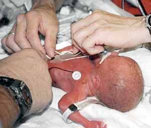 india_Premature-Birth-Rate