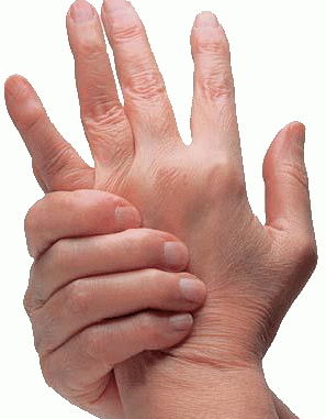 health_arthritis