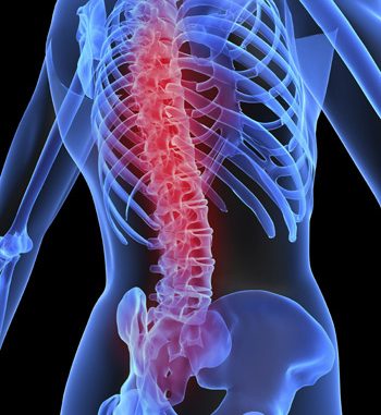 osteoporosis_1_copy