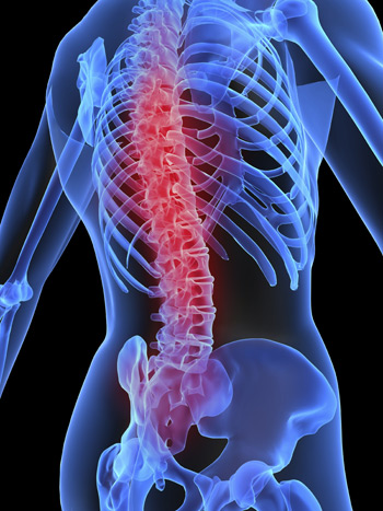 osteoporosis_1_copy