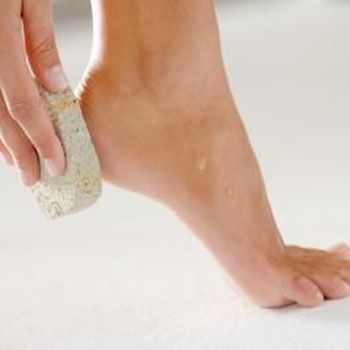 fashion_Away_with_Cracked_Heels