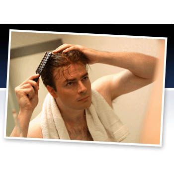 images_Lifestyle_Health_Male_Pattern_Baldness