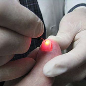 images_Lifestyle_Fashion_nail_plastic_surgery_1