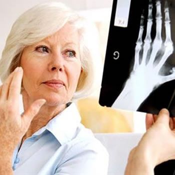 images_Lifestyle_Health_what_is_rheumatoid_arthritis