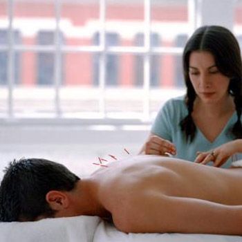images_Lifestyle_Health_can_acupuncture_improve_your_workout