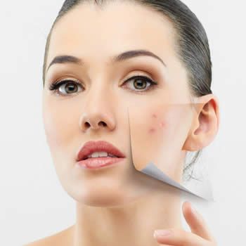 images_Lifestyle_DailyLife_stop_picking_acne