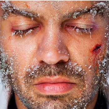 images_Lifestyle_DailyLife_Winter_Proof_Your_Skin