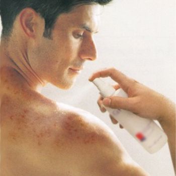images_Lifestyle_Health_Bacne_and_Acne_Prevention