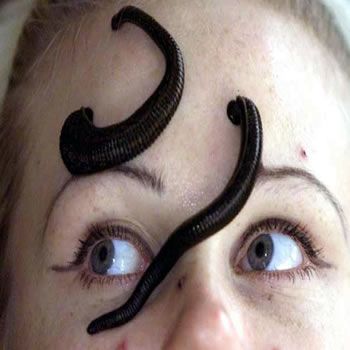 images_Lifestyle_Fashion_leech_therapy
