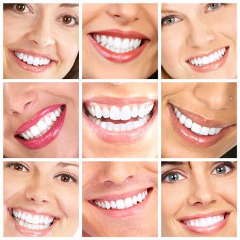 images_Lifestyle_DailyLife_teeth_whitening