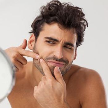 images_Lifestyle_Health_Heal_Acne_Fast_Via_Homemade_Remedies