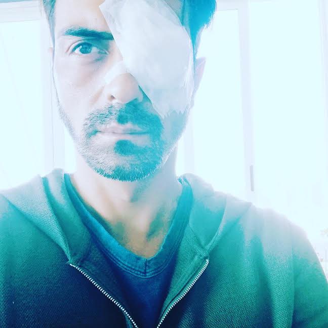 Arjun Rampal suffers