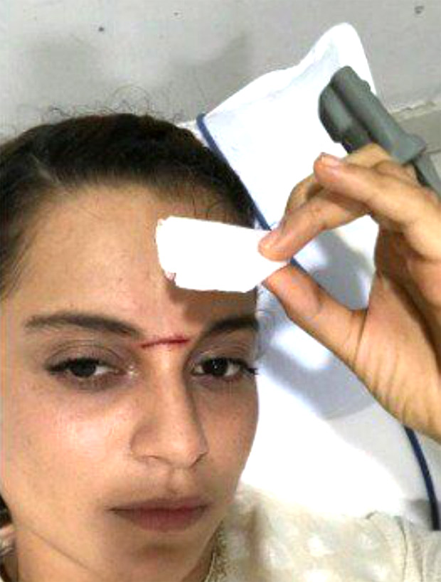 OMG! Kangna Ranaut gets SEVERELY INJURED while shooting for Manikarnika- The Queen Of Jhansi