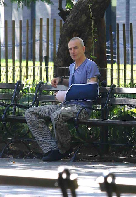 daniel day- lewis is sitting on a park bench with a broken arm