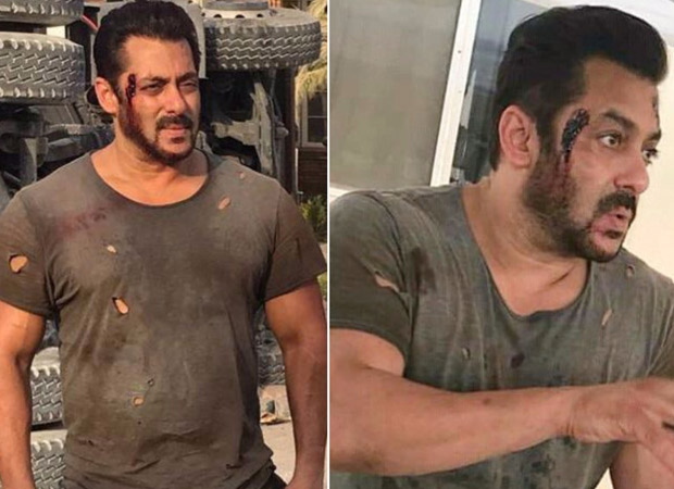 Tiger Zinda Hai Salman Khan's bruised look proves he is ready to enthrall the audience with breathtaking action sequences (1)