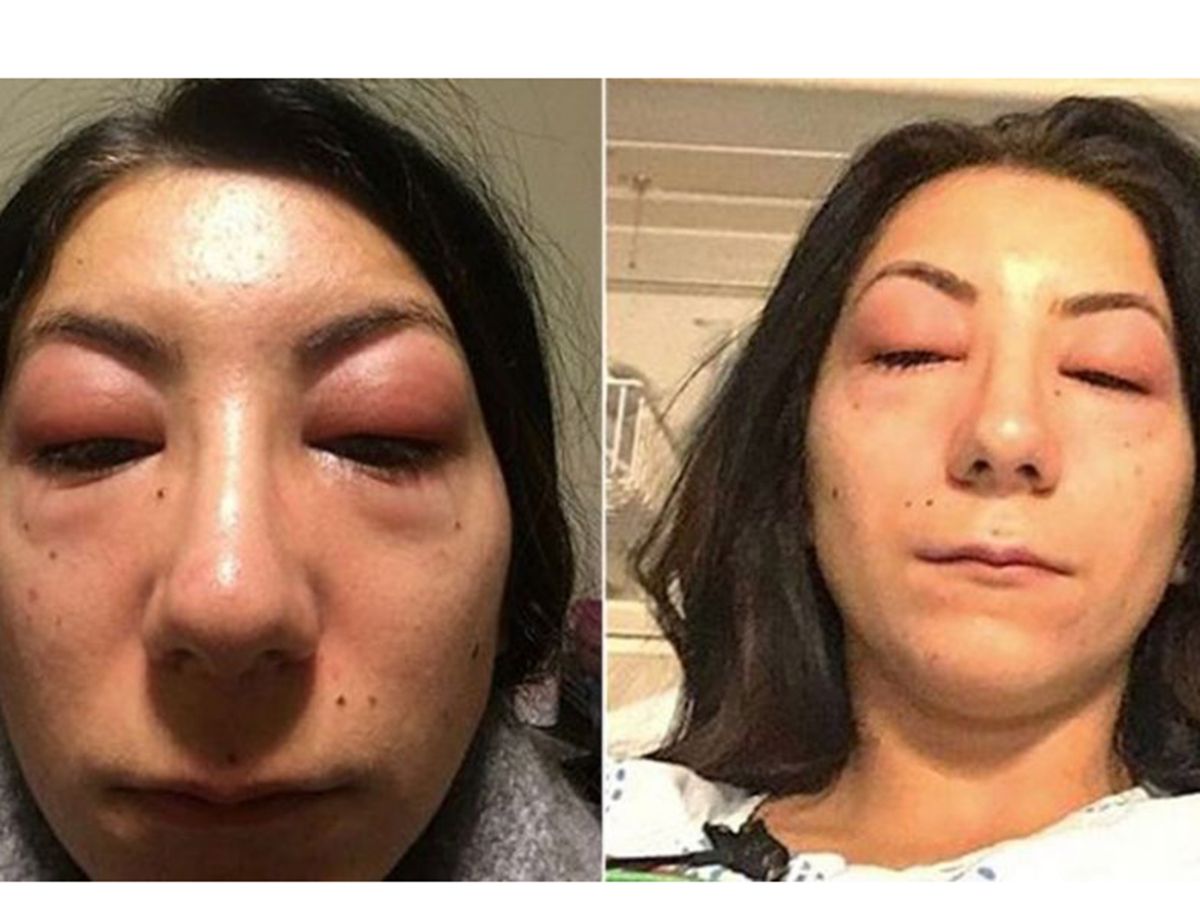 this woman’s story is a terrifying example of eyelash extensions gone wrong