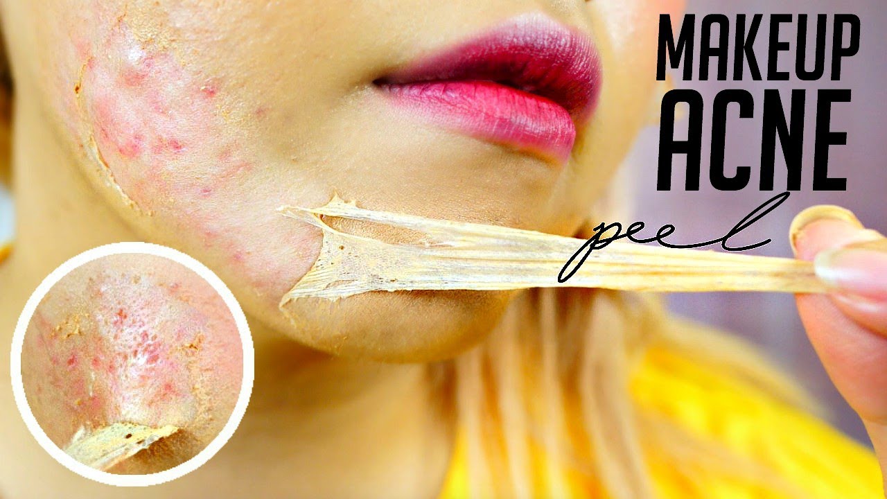 I Tried This Bizarre Face Peel & The Results Might Scare You