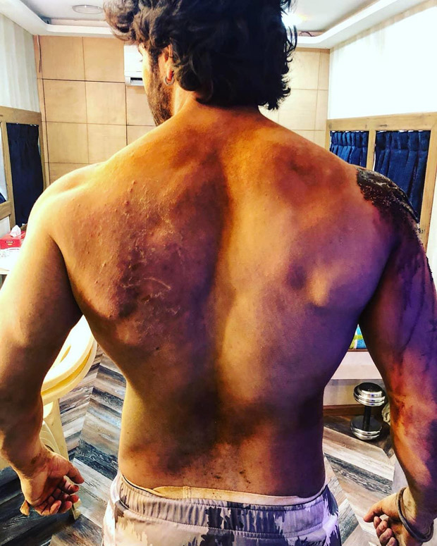 GUESS WHO? This actor gets BRUISED during battle sequence shoot