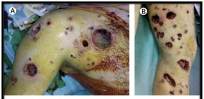 white phosphorus america’s weapon of choice?