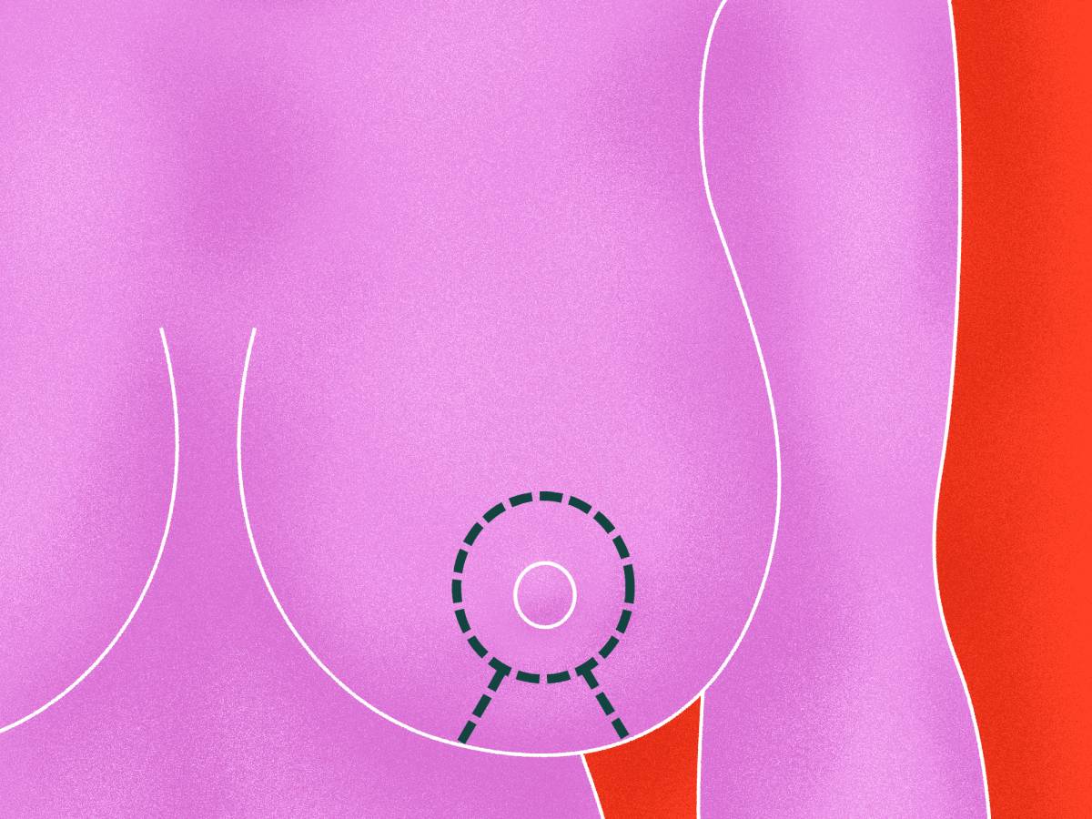 Breast Reduction danger back problems,