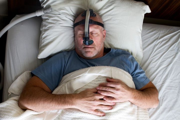 Allergies Sleep Apnea,