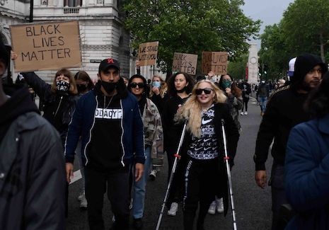 crutches don’t stop madonna from protesting