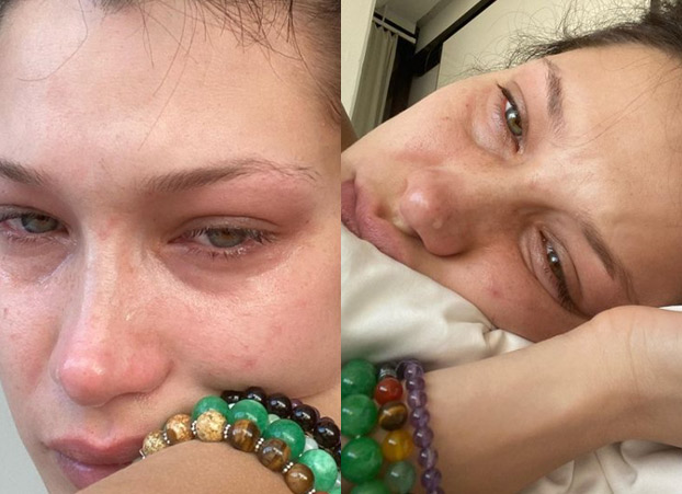 bella hadid talks about her mental health and anxiety battle by sharing crying selfies – ‘this is me everyday’