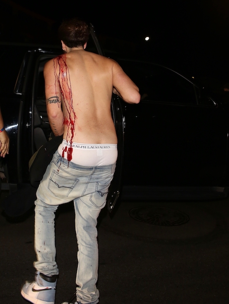 this happened at a justin bieber party – really